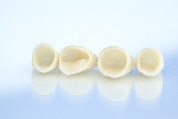 Signs You May Have Damaged Dental Crowns