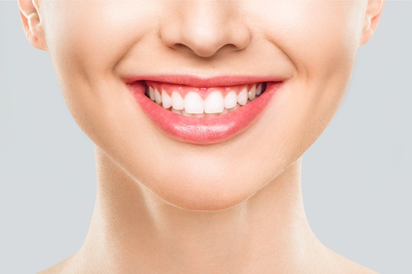 Why Many Prefer At Home Teeth Whitening